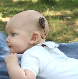 bebe-con-implante-coclear1