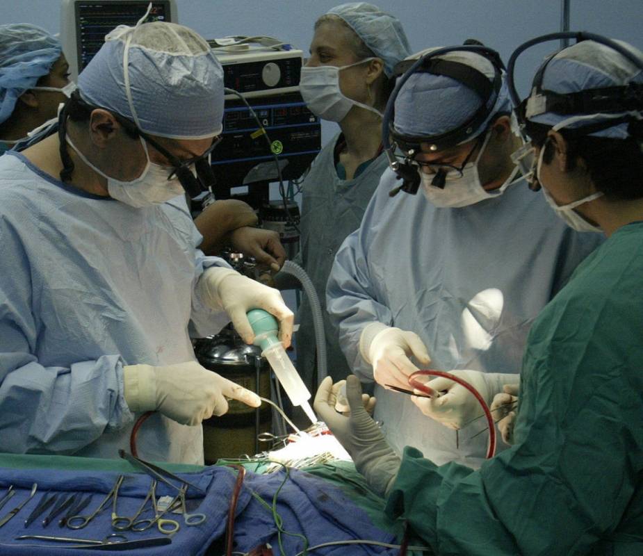 operacion